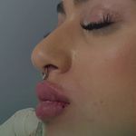 مرکز لیزر و کلینیک زیبایی الیسو