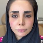 مرکز لیزر و کلینیک زیبایی الیسو