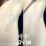 مرکز لیزر و کلینیک زیبایی آروین