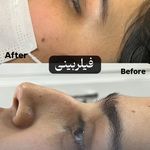 کلینیک زیبایی و لیزر سلن مشهد