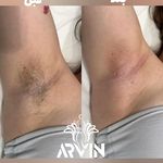 مرکز لیزر و کلینیک زیبایی آروین