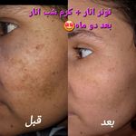 مشاوره تخصصی پوست و مو نورا