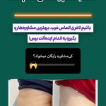 کلینیک زیبایی و لاغری الماس غرب