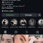 خدمات میکروبلیدینگ ابرو نگین