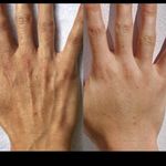 کلینیک تخصصی لیزر و لاغری اکتا(okta)