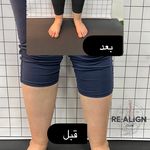 مرکز حرکات اصلاحی ری الاین