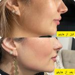 کلینیک تخصصی لیزر و لاغری اکتا(okta)