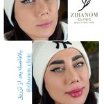 کیلینیک زیبا نوم