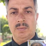 کلینیک کاشت مو صالحی