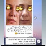 لیفت و فرم دهی بینی بهناز کامران