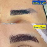 آکادمی تاتو و ریموو مریم اکبری