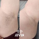 مرکز لیزر و کلینیک زیبایی آروین