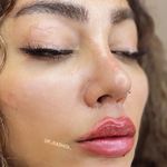 کلینیک تخصصی لیزر پوست مو مه سیما