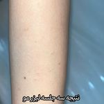 کلینیک زیبایی و لیزر نگین شرق