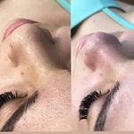 کیلینیک فیشیال و پاکسازی پوست