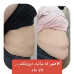 کلینیک تغذیه و مرکز لاغری الماسی