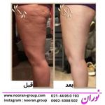کلینیک تخصصی لاغری موضعی نوران