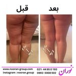 کلینیک تخصصی لاغری موضعی نوران