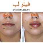 مطب پوست و زیبایی و لیزر بنفشه