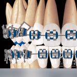 متخصص ارتودنسی دکتر جهانبخشی