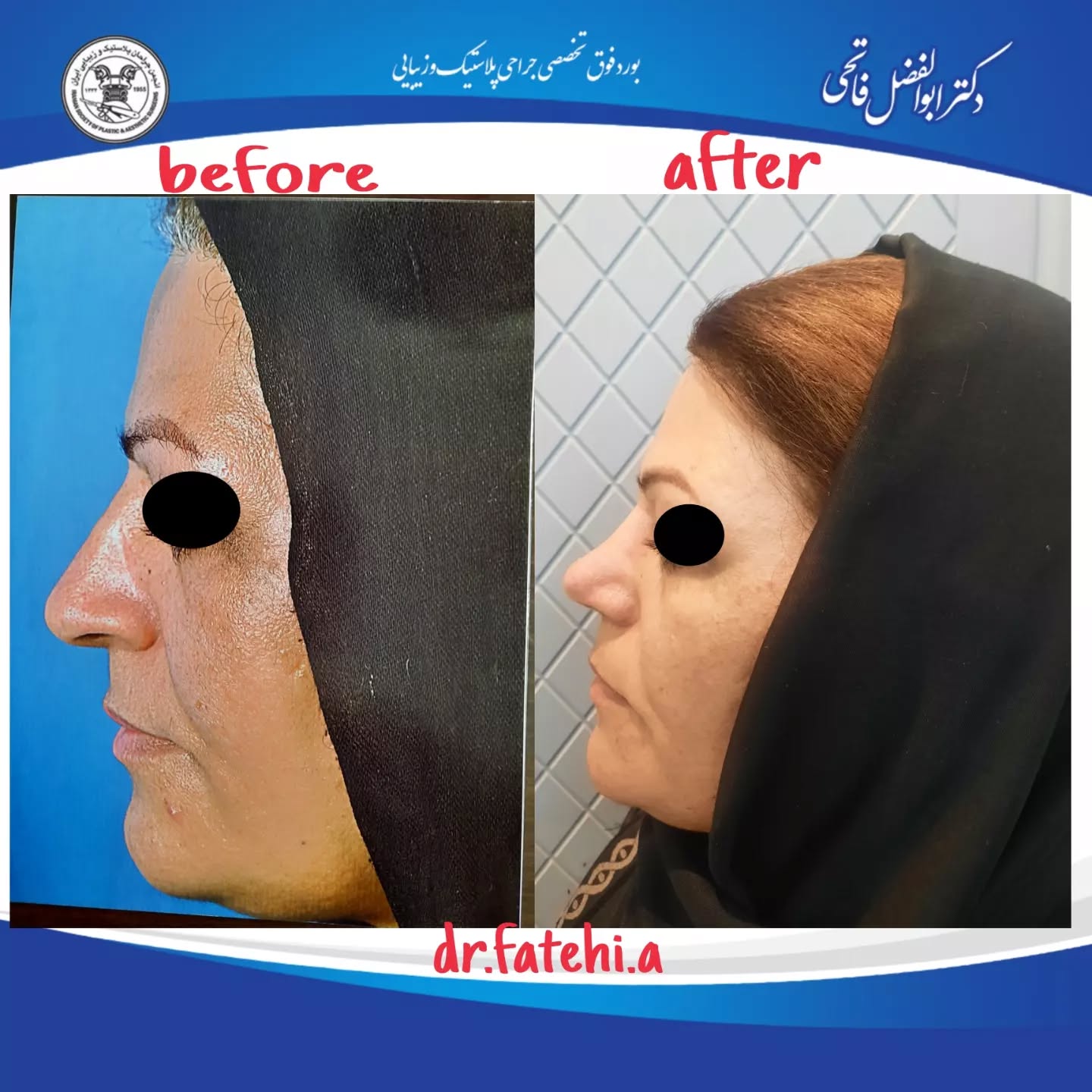 دکتر ابوالفضل فاتحی میبدی
