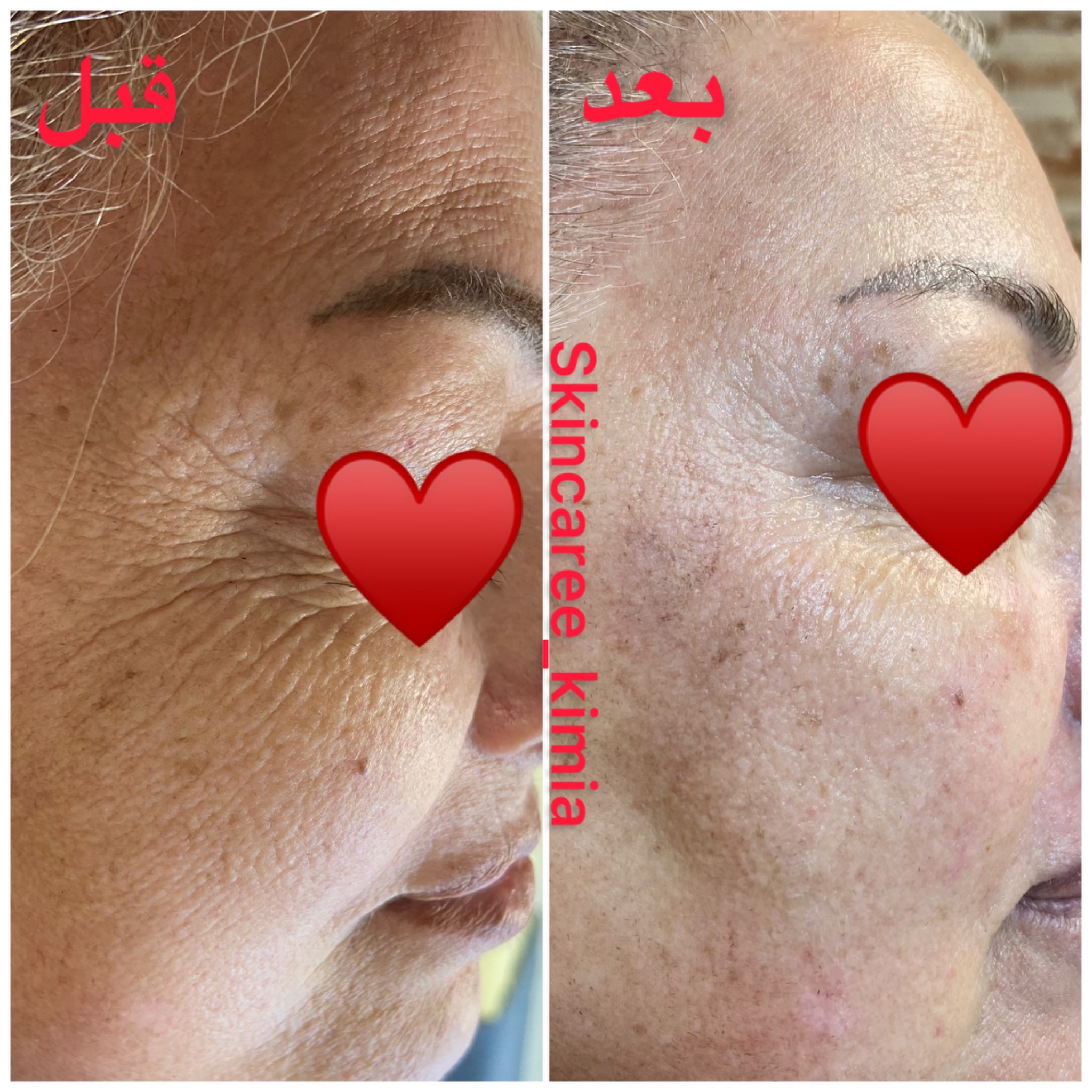 پاکسازی پوست کیمیا صدری