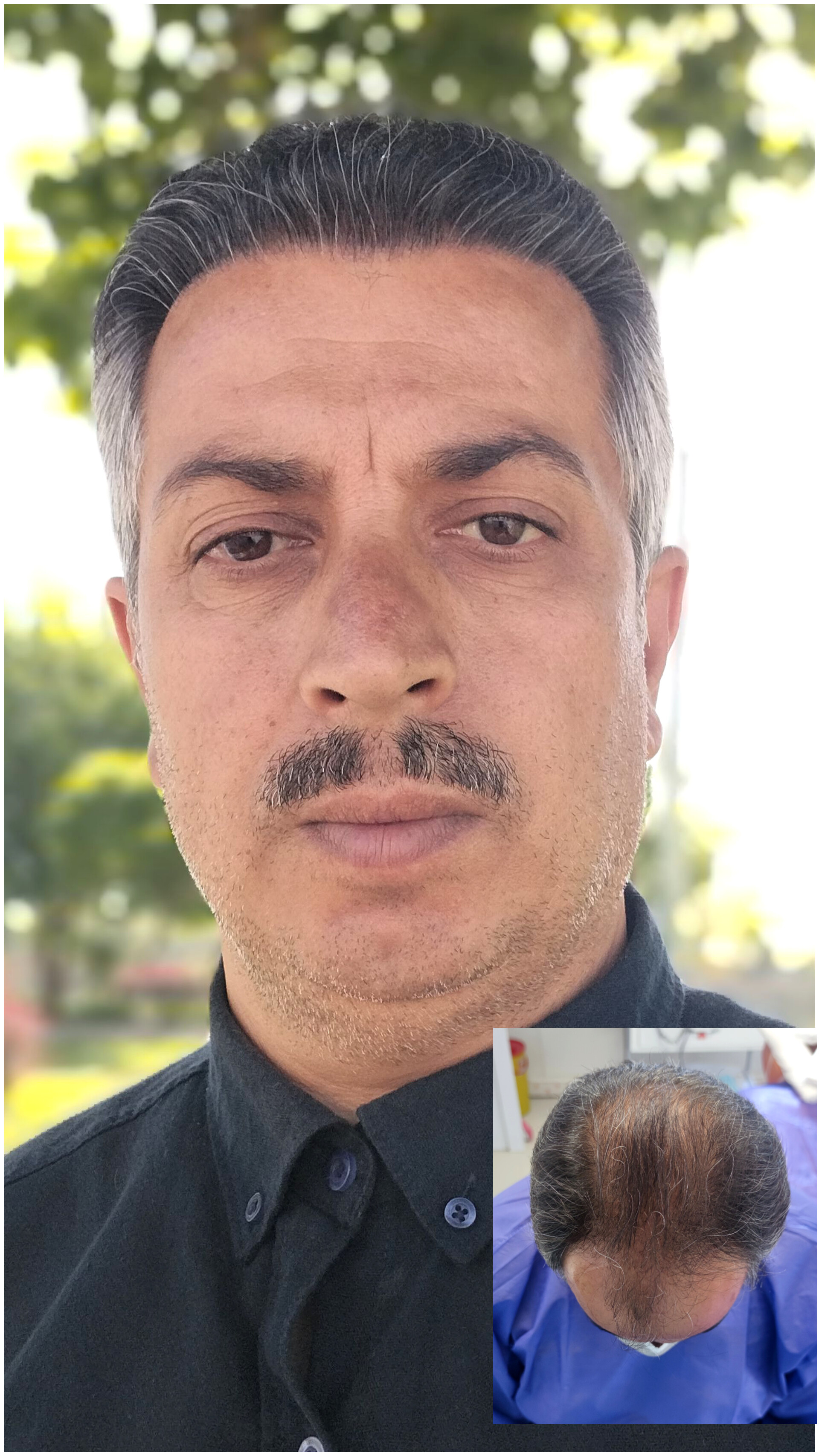 کلینیک کاشت مو صالحی