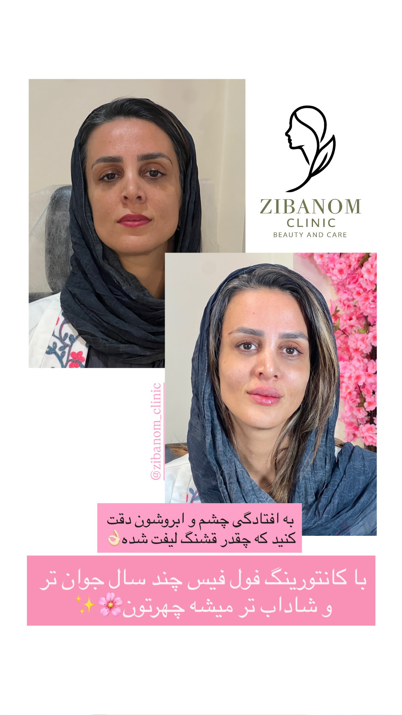 کیلینیک زیبا نوم